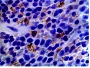 NB110-85474 - Dendritic cells