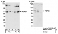 NB100-86989 - WDR20 / DMR