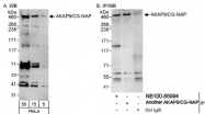 NB100-86994 - AKAP9