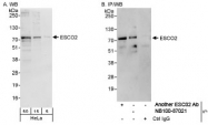 NB100-87021 - ESCO2