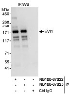 NB100-87023 - EVI1