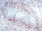 NB100-105H - HIF1A / HIF1 alpha
