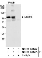 NB100-88136 - Numb-like protein / NUMBL