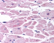 NB100-902HIF2 - HIF2A / HIF2 alpha