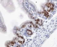 NB110-89719 - mKi-67