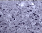 NB100-91270 - Rho