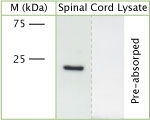 NB100-91350 - VAMP-1 / Synaptobrevin-1
