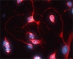 NB100-91352 - VAMP-2 / Synaptobrevin-2