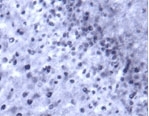 NB100-91352 - VAMP-2 / Synaptobrevin-2