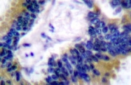 NB100-91678 - BIK