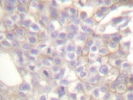 NB100-91679 - Bcl-2-like 11