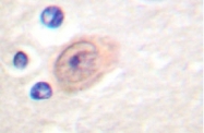 NB100-91723 - XPO2 / Exportin-2