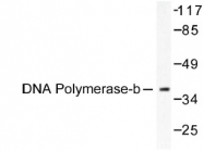 NB100-91734 - DNA polymerase beta