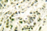 NB100-91734 - DNA polymerase beta