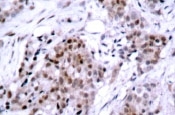 NB100-91758 - Estrogen receptor alpha