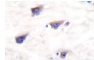 NB100-91788 - mGluR8 / GRM8