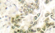 NB100-91800 - HDAC1