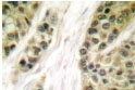 NB100-91803 - HDAC5