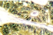 NB100-91805 - HDAC6
