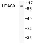 NB100-91808 - HDAC9