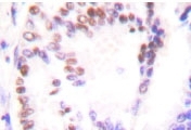 NB100-91808 - HDAC9