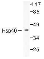 NB100-91818 - DNAJB1 / HSP40