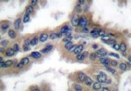 NB100-91818 - DNAJB1 / HSP40