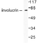 NB100-91829 - Involucrin / IVL
