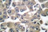 NB100-91829 - Involucrin / IVL