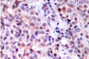 NB100-91893 - RELA / NF-kB p65