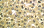 NB100-91952 - RAR-beta / RARB