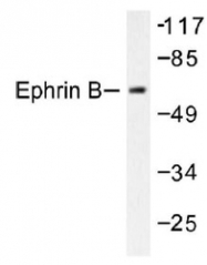 NB100-92031 - EPHB1