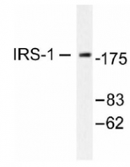 NB100-92041 - IRS1