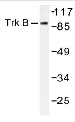 NB100-92063 - TrkB