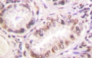 NB100-92166 - Estrogen receptor alpha