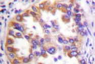 NB100-92235 - TSC2 / Tuberin
