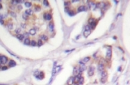 NB100-92250 - Vinculin (VCL)