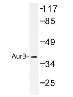 NB100-92254 - Aurora kinase B