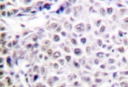 NB100-92254 - Aurora kinase B