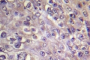 NB100-92263 - RhoA