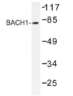 NB100-92282 - BACH1