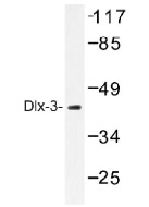 NB100-92289 - DLX3