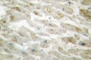 NB100-92289 - DLX3