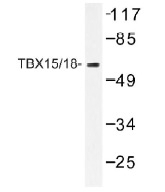 NB100-92302 - TBX15