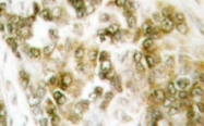 NB100-92302 - TBX15