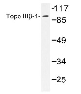 NB100-92303 - TOP3B
