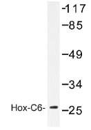 NB100-92309 - HOXC6 / HOX3C