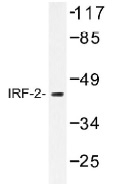 NB100-92317 - IRF2