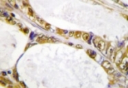 NB100-92317 - IRF2