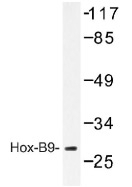 NB100-92323 - HOXB9 / HOX2E